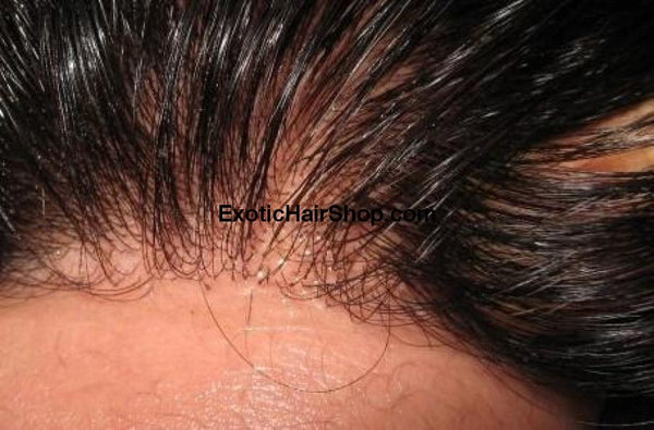 HD Thin Lace Frontal - 13x4 - Exotic Hair Shop
