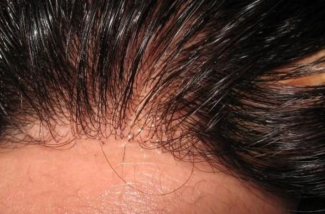 HD Film Lace / Illusion Lace Closure - 5x5 - Exotic Hair Shop